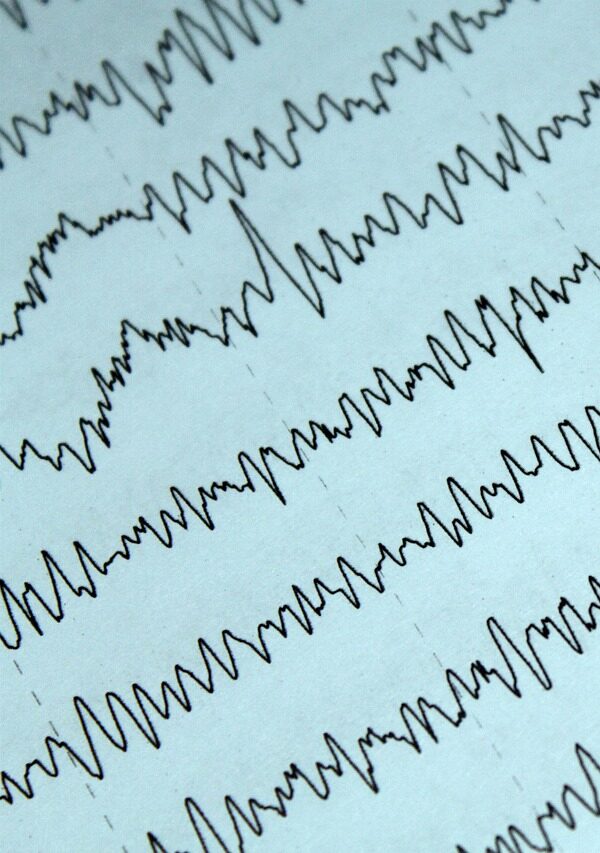 Diagnósticos EEG